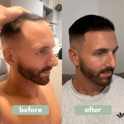 Origin Labs™ - Hair Growth Serum