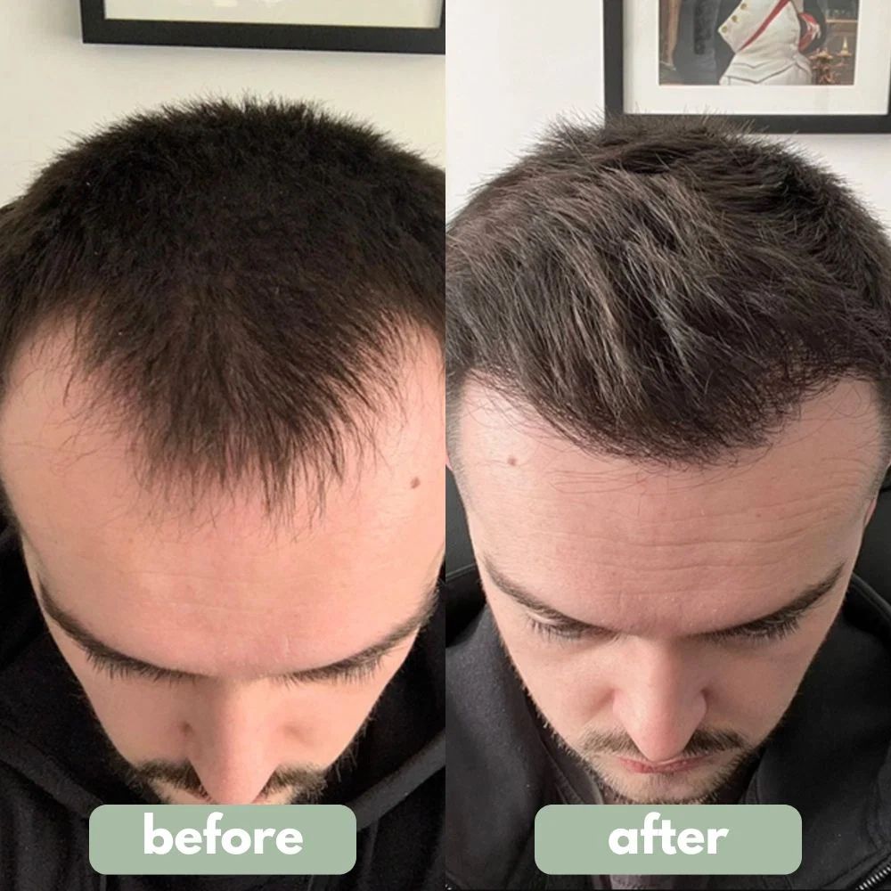 Origin Labs™ - Hair Growth Serum