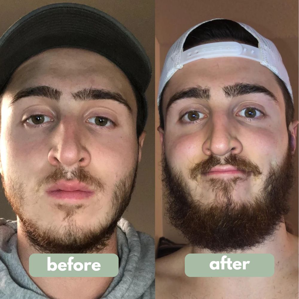 Origin Labs™ - Beard Growth Serum