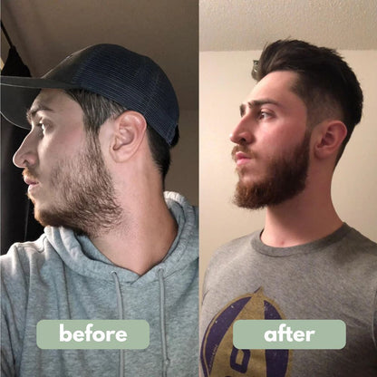 Origin Labs™ - Beard Growth Serum