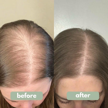Origin Labs™ - Women's Hair Growth Serum