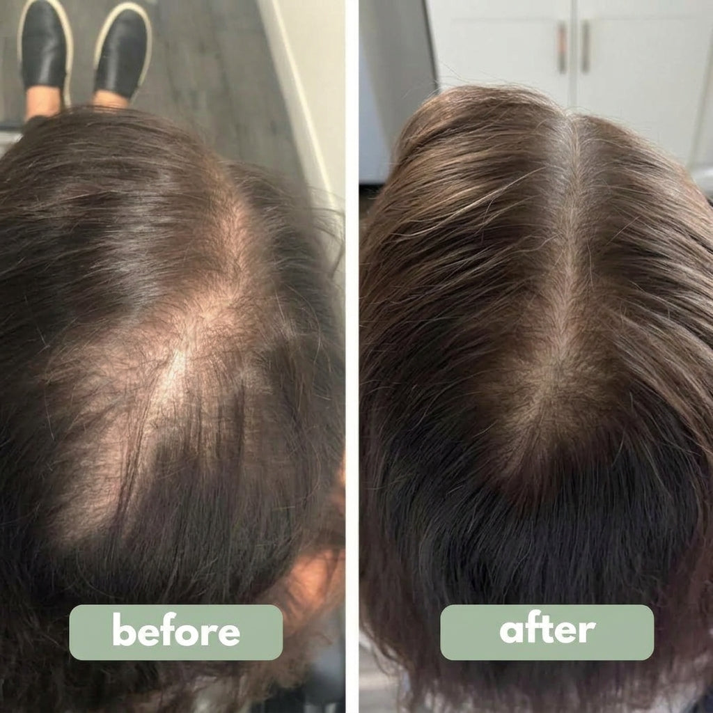 Origin Labs™ - Women's Hair Growth Serum