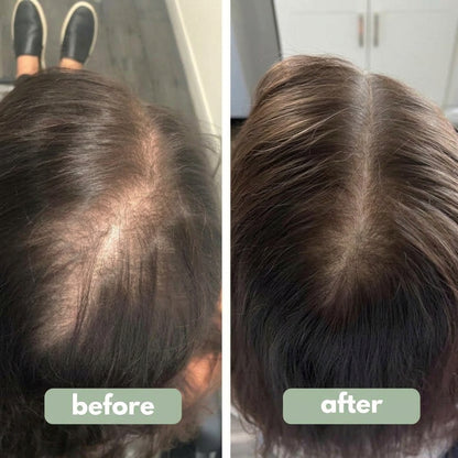 Origin Labs™ - Women's Hair Growth Serum
