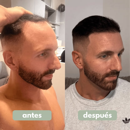 Origin Labs™ - Sérum Para El Cabello